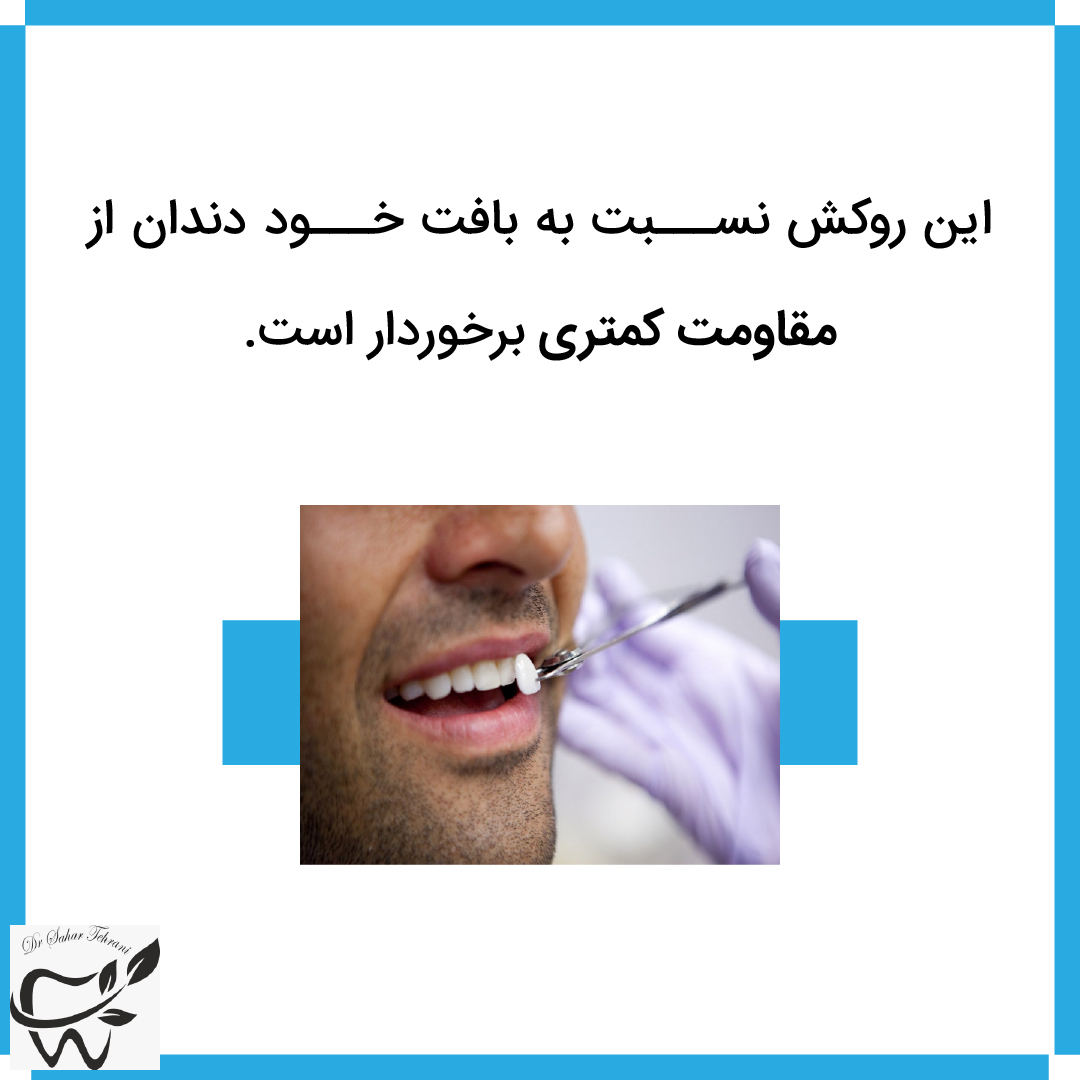 لومیرینز دندان چیست؟ دکتر سحر طهرانی، دندانپزشک، تهران