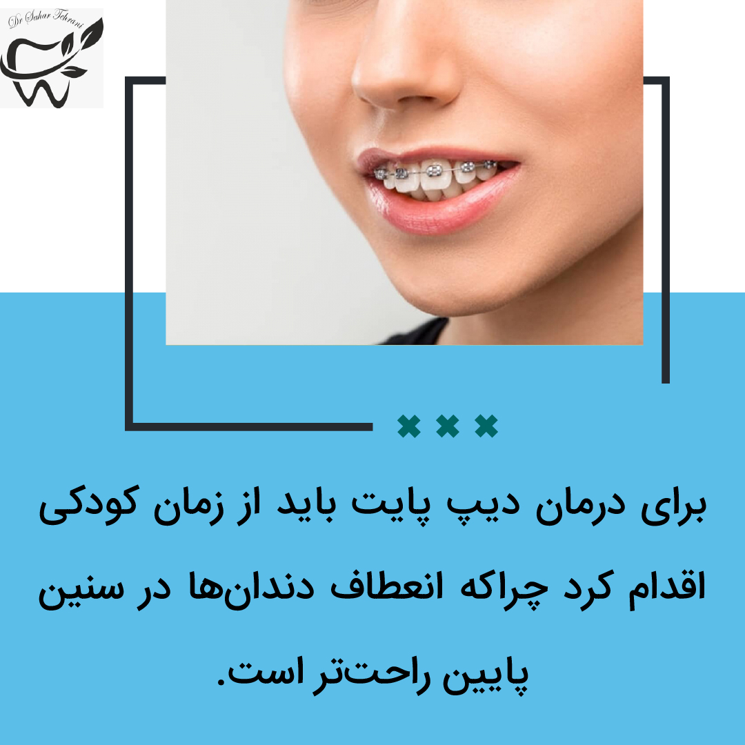 دیپ پایت چیست و چگونه درمان می شود؟، دکتر سحر طهرانی، دندانپزشک، تهران